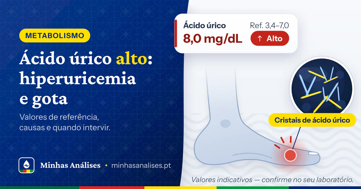 Pé com a articulação do dedo grande inflamada, cristais de ácido úrico em agulha e resultado de 8,0 mg/dL marcado como alto