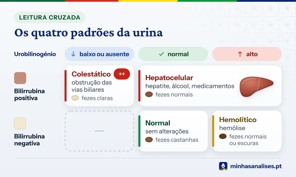 Matriz que cruza bilirrubina e urobilinogénio na urina com os padrões normal, hemolítico, hepatocelular e colestático