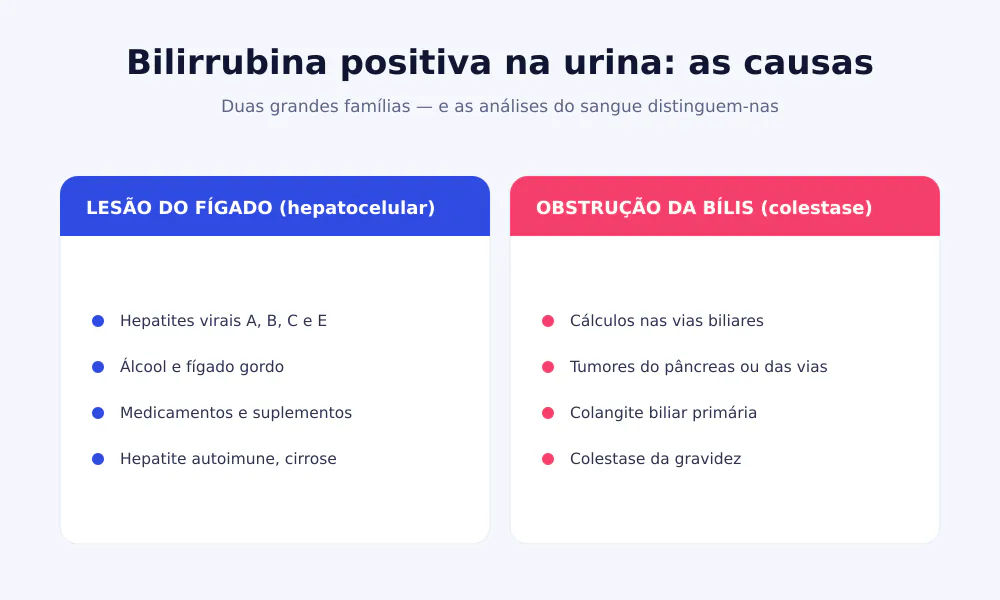Duas colunas com as causas de bilirrubina positiva na urina: lesão do fígado e obstrução da bílis