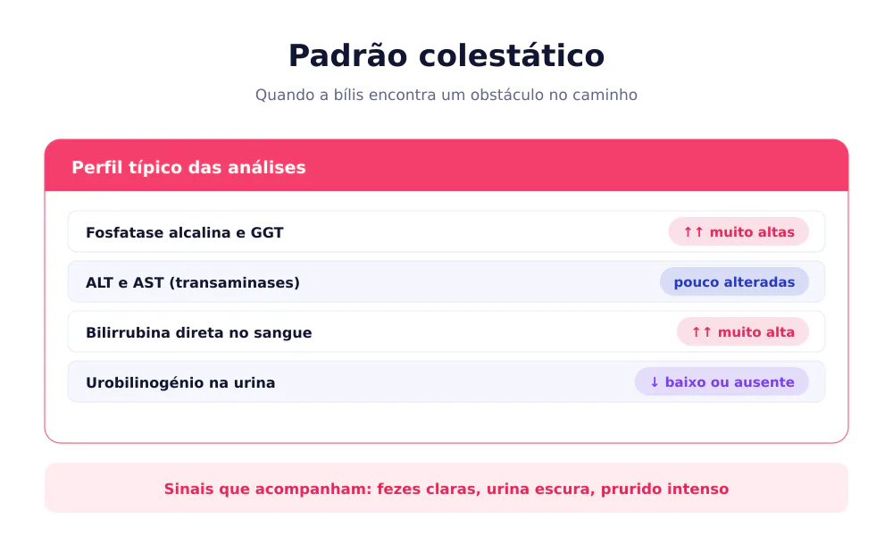 Perfil laboratorial do padrão colestático com fosfatase alcalina e GGT muito altas e urobilinogénio ausente