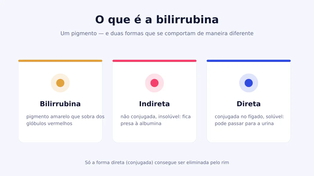 Três cartões a explicar a bilirrubina, a forma indireta não conjugada insolúvel e a forma direta conjugada solúvel