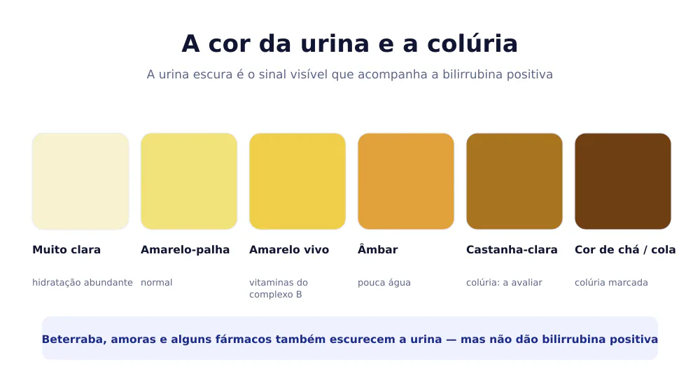 Escala de cores da urina, da muito clara à cor de chá, com a interpretação de cada tonalidade