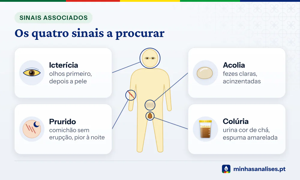 Silhueta do corpo com olhos amarelos e quatro cartões: icterícia, urina cor de chá, fezes claras e prurido sem erupção