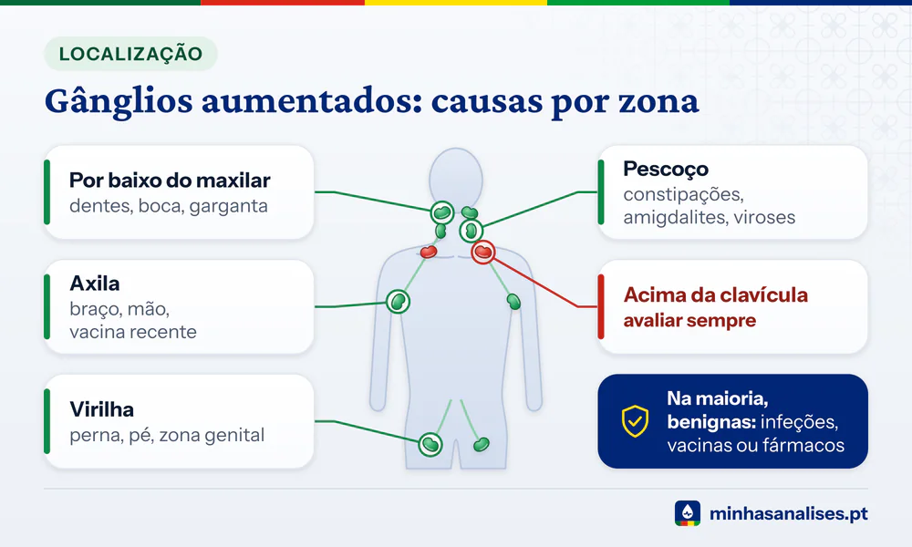 Silhueta do corpo com gânglios no maxilar, pescoço, axila, virilha e acima da clavícula, cada zona com as causas frequentes