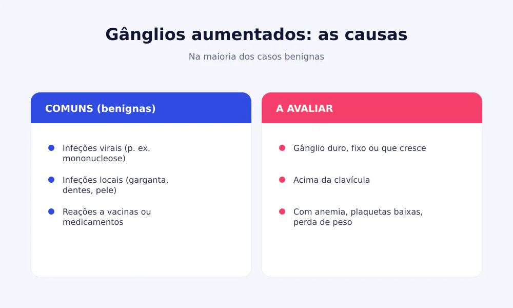 Causas dos gânglios linfáticos aumentados: comuns e benignas (infeções virais e locais) e situações a avaliar (gânglio duro, fixo, acima da clavícula)