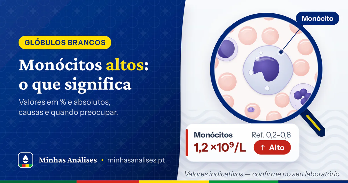 Monócito com núcleo em forma de rim ampliado por uma lupa e resultado de monócitos a 1,2 ×10⁹/L assinalado como alto