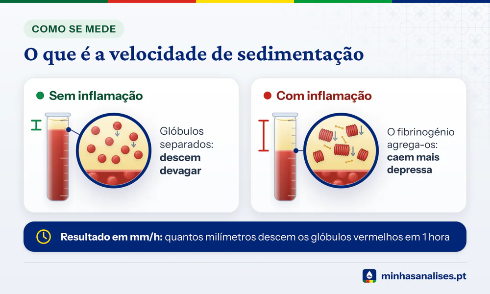 Dois tubos de velocidade de sedimentação: glóbulos separados descem devagar, agregados pela inflamação caem mais depressa