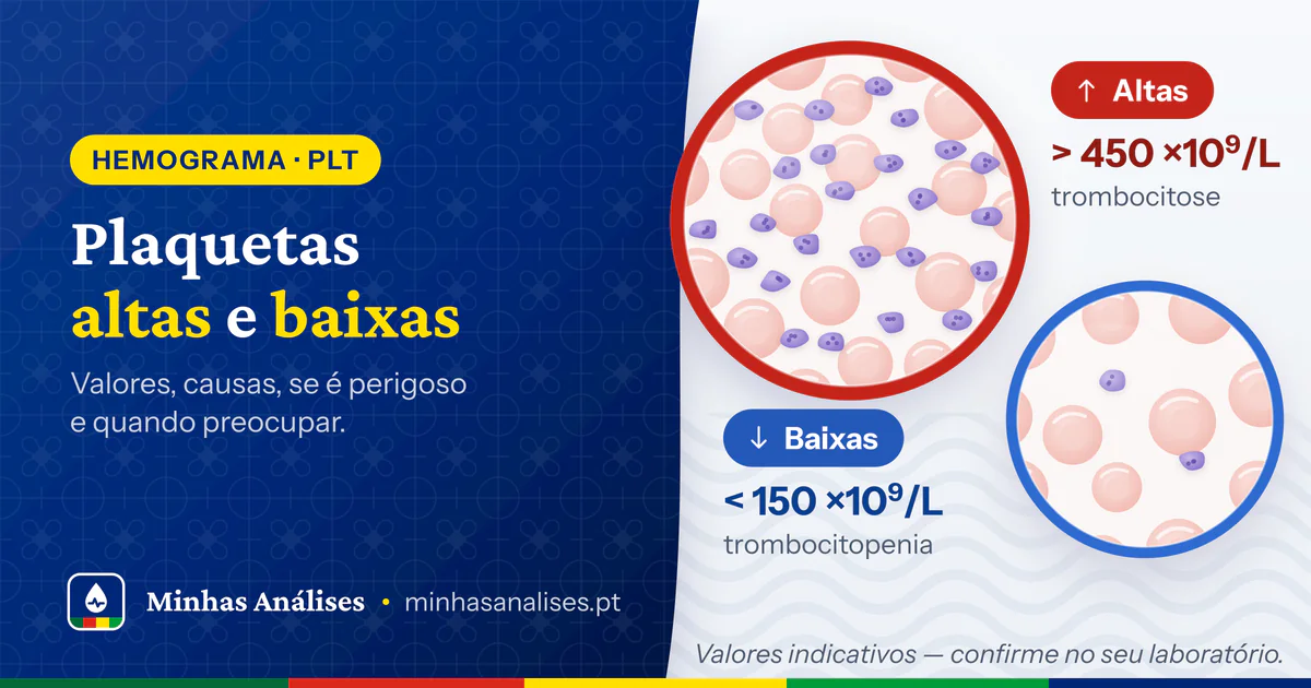 Campo de microscópio cheio de plaquetas, acima de 450 ×10⁹/L, e outro com muito poucas, abaixo de 150 ×10⁹/L