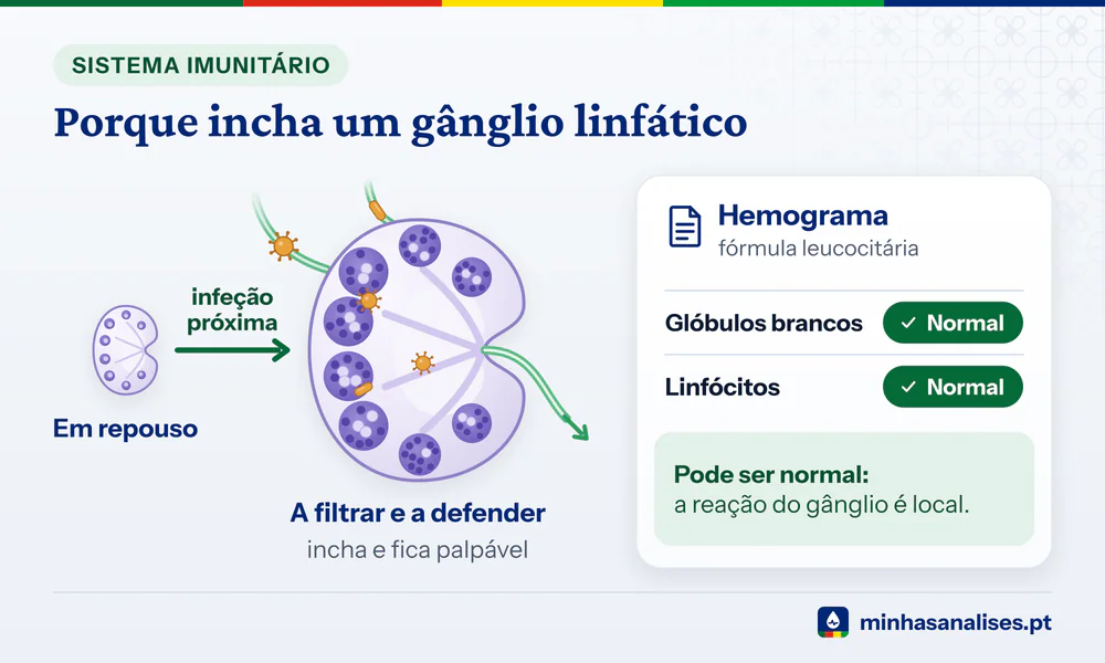 Gânglio linfático em repouso e o mesmo gânglio aumentado a filtrar micróbios, ao lado de um hemograma com resultados normais